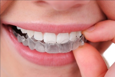 Làm sao chọn một nha khoa uy tín ?