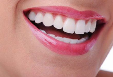 Tẩy trắng răng có an toàn không?
