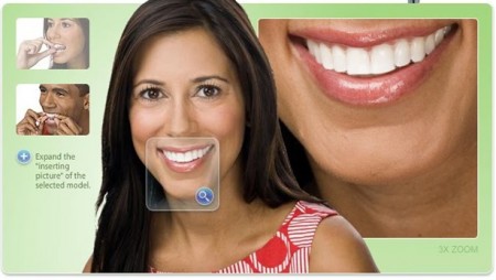 Ưu điểm của giải pháp niềng răng không mắc cài