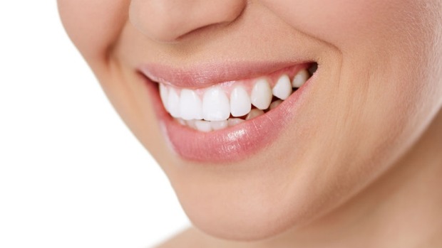 Tẩy trắng răng có chi phí bao nhiêu ? 3