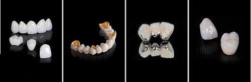 Chụp răng sứ giá bao nhiêu? Có đắt không? 1