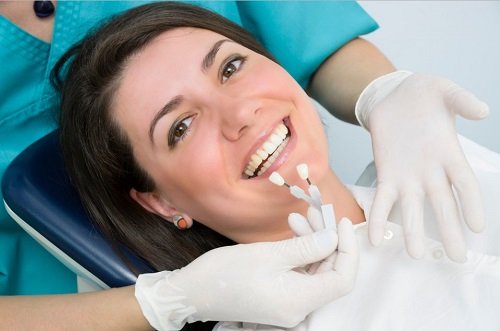 Chụp răng sứ giá bao nhiêu? Có đắt không? 3