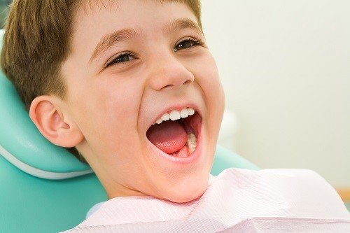 Trám răng cho trẻ em cần lưu ý những điều gì? 1