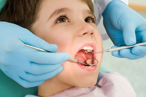 Trám răng cho trẻ em cần lưu ý những điều gì? 2